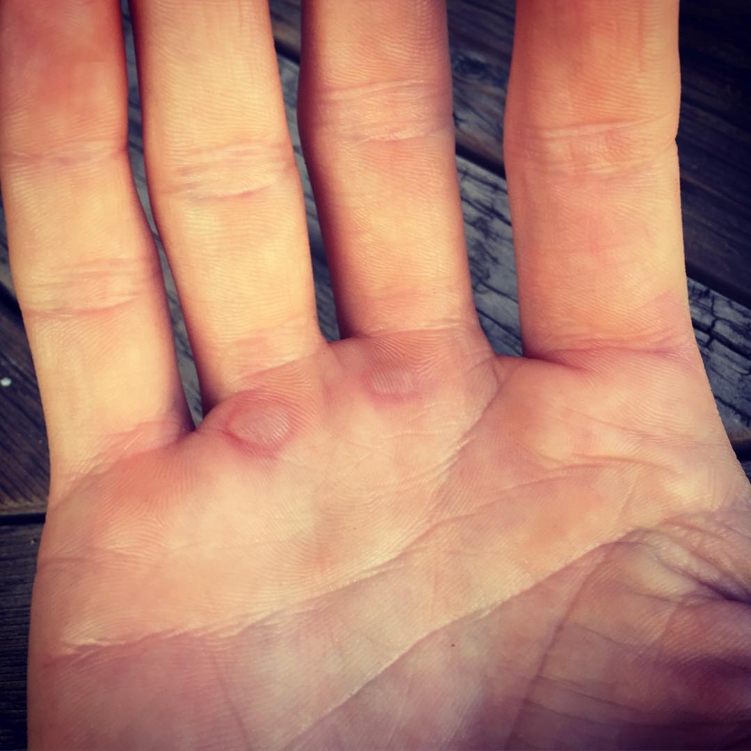 #yardwork #tilling #blisters#gardening